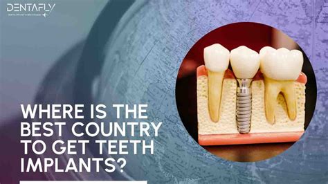 best country for dental implants